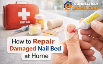 How to Repair Damaged Nail Bed at Home Safely